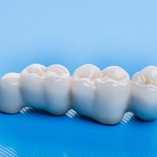 A closeup of a dental bridge against a blue background