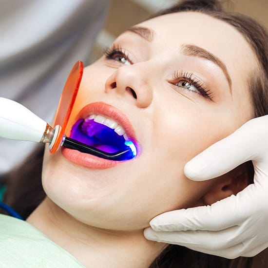 Cosmetic dental bonding