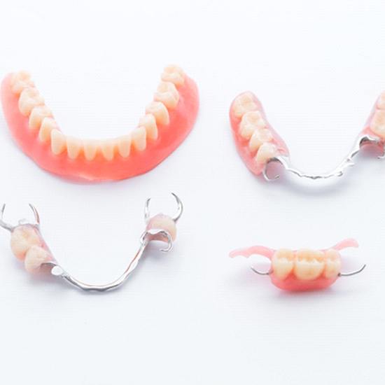 Diagram showing a model of implant dentures in Fairfax