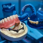 implant dentures in Fairfax