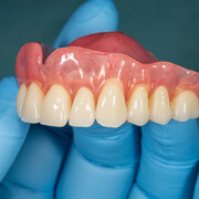 Closeup of an upper arch of dentures held by a hand in a blue glove