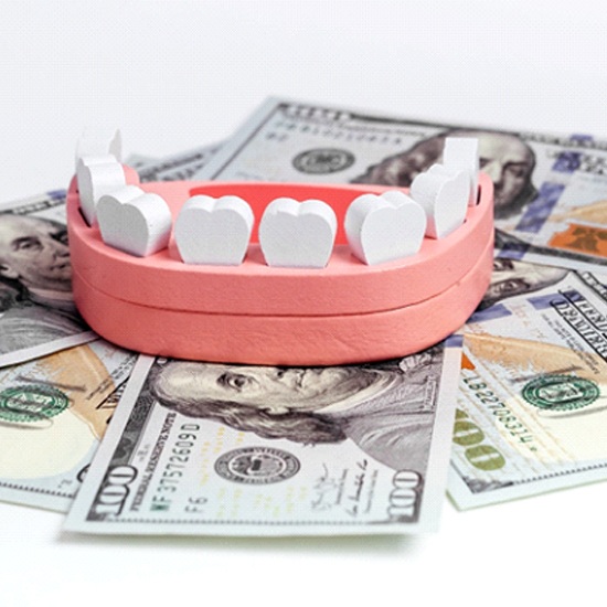 model of teeth representing cost of tooth extractions in Fairfax