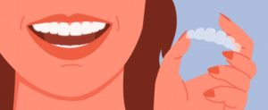 girl holding Invisalign aligner	illustration 