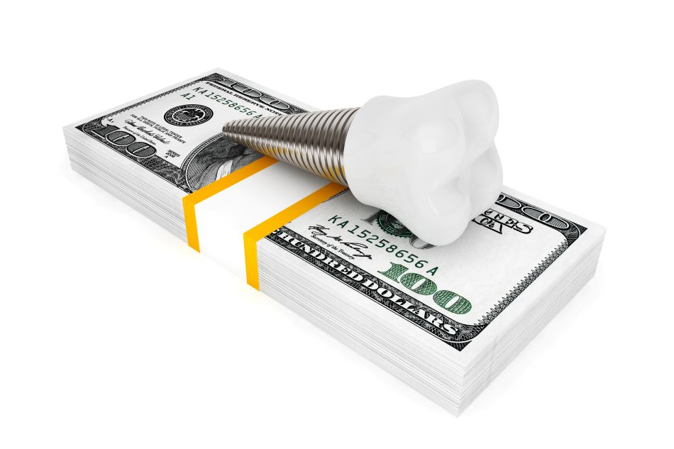 A dental implant on a stack of money